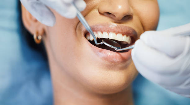 Best Emergency Wisdom Tooth Extraction in Garfield, NJ